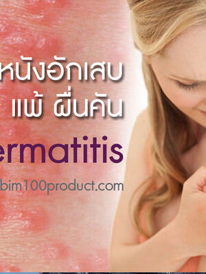 BIM100 ประสบการณ์ผู้ใช้กับปัญหาผิวหนังอักเสบ แพ้ ผื่นคัน