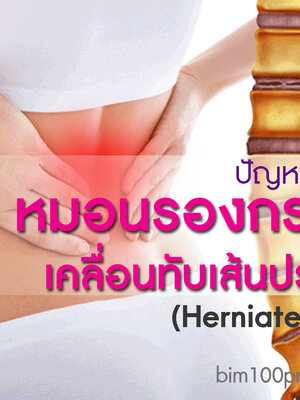 BIM100 ประสบการณ์ผู้ใช้กับปัญหาหมอนรองกระดูกทับเส้นประสาท