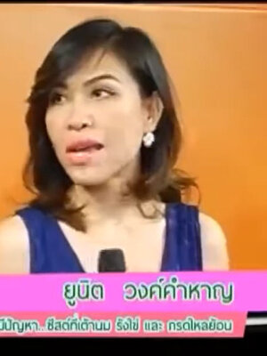 BIM100ผู้มีปัญหาซีสต์ที่เต้านม คุณยูนิต วงค์คำหาญ