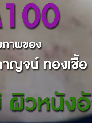 BIM100 กับปัญหาสุขภาพของ คุณพุทธิกาญจน์ ทองเชื้อ ภูมิแพ้ ผิวหนังอักเสบ