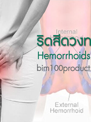 BIM100 ประสบการณ์ผู้ใช้กับปัญหาริดสีดวงทวาร