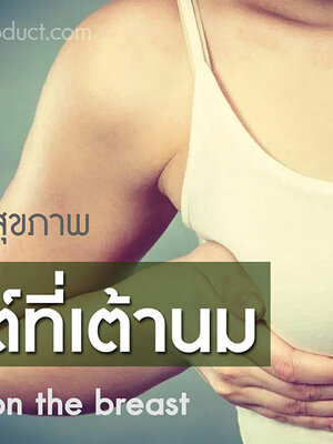 BIM100 กับปัญหาซีสต์ที่เต้านม